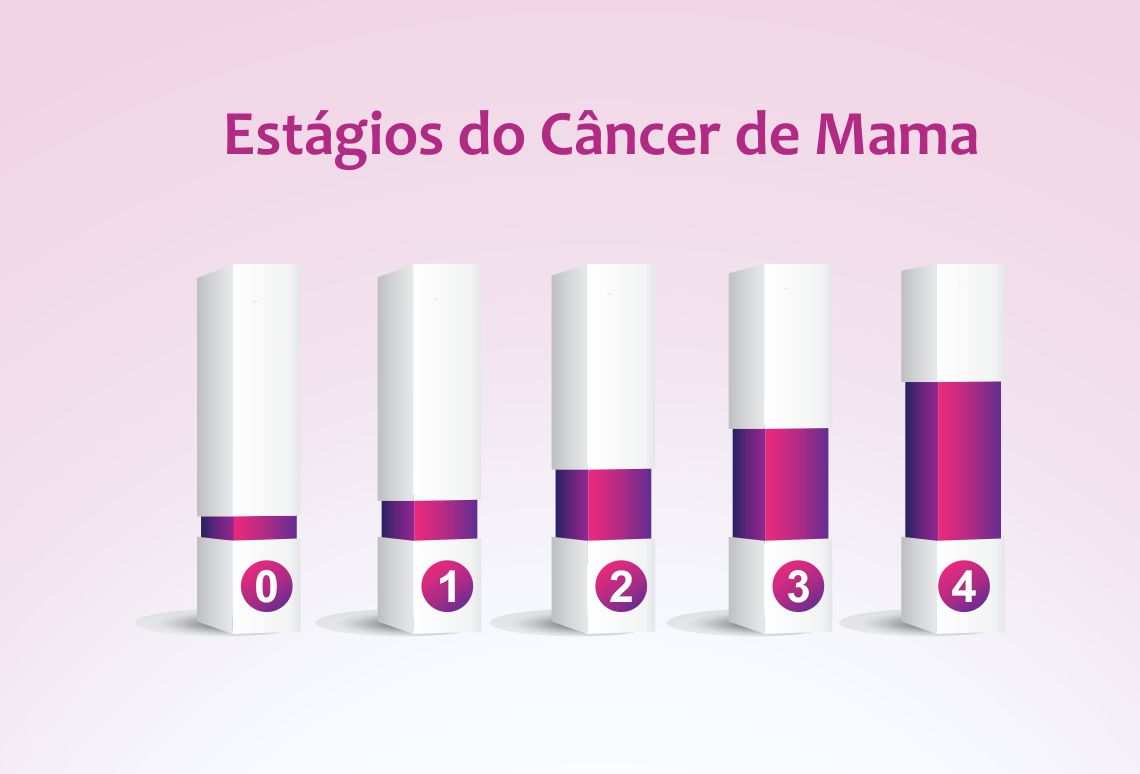 Estágios do Câncer de Mama Estágios do Câncer de Mama